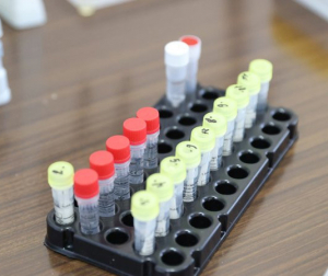 Беларусь з 28 мая адмяняе ПЛР-тэсты для ўезду замежных грамадзян